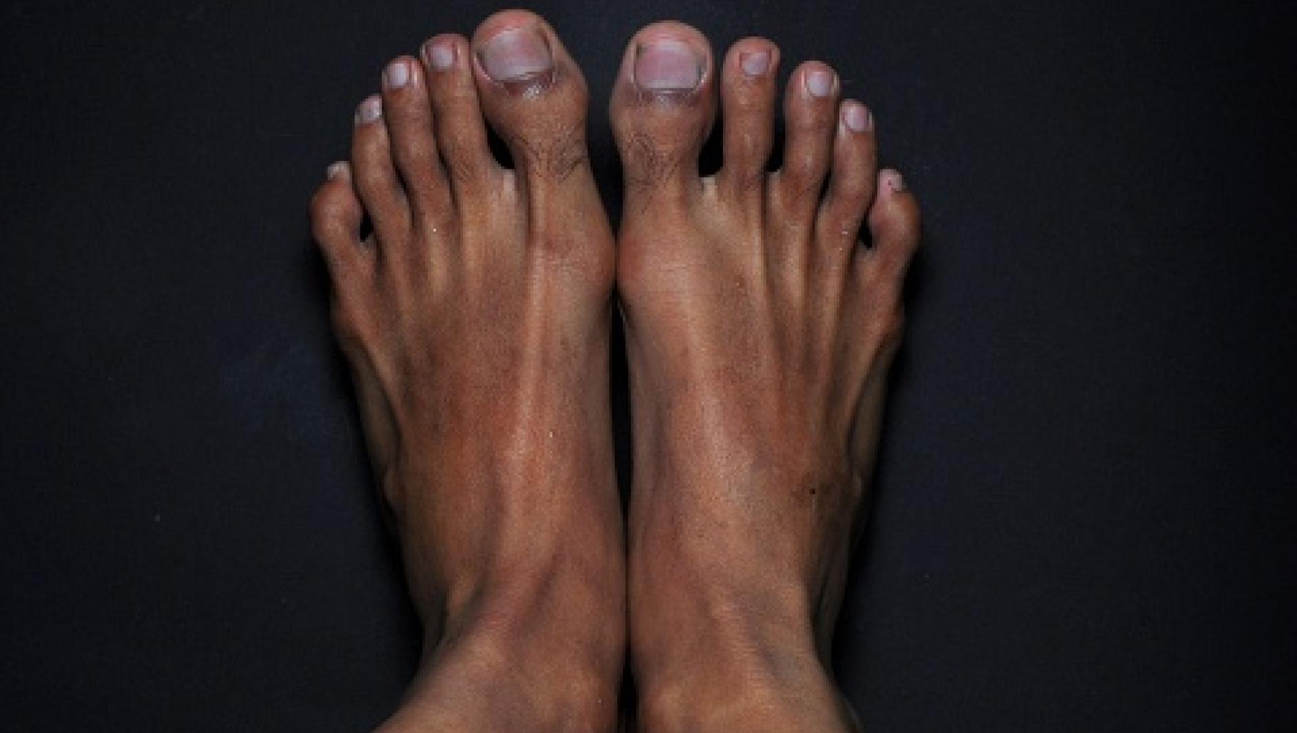 Feet