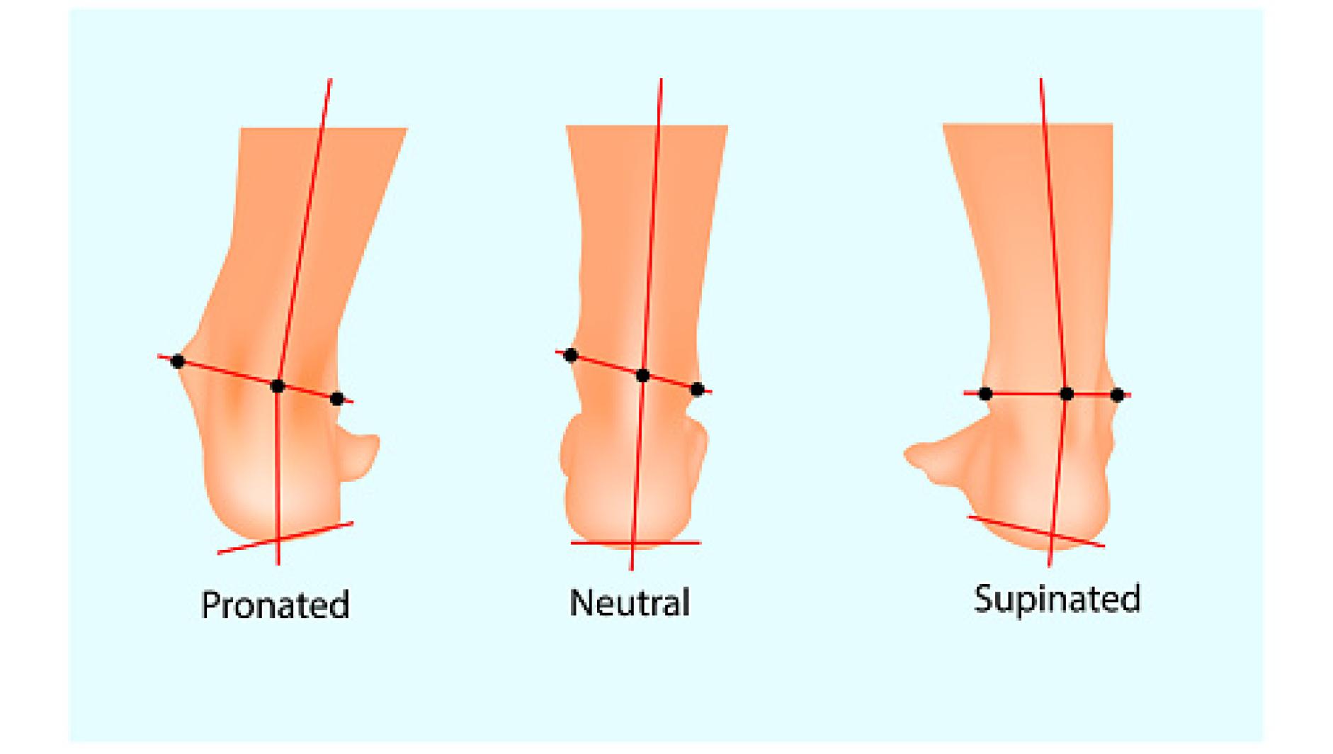 foot weakness