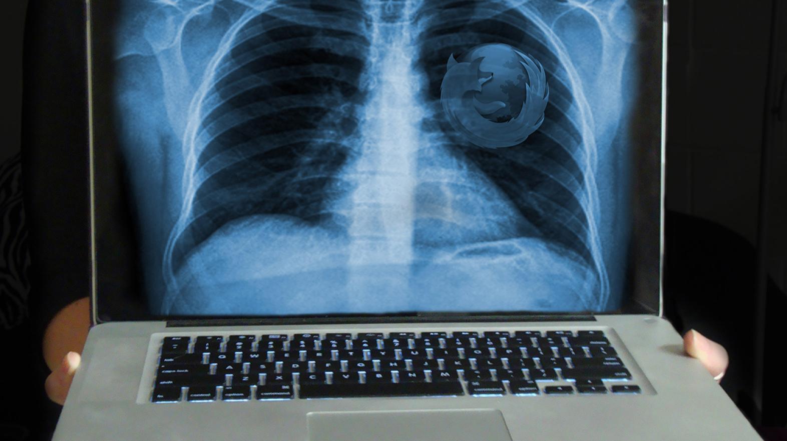 A piece of student work that depicts an image of an x-ray of the chest with the Mozilla Firefox logo where the heart should be on a laptop.